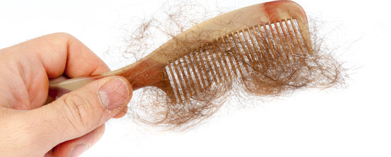 掉发是什么原因，如何有效防止掉发